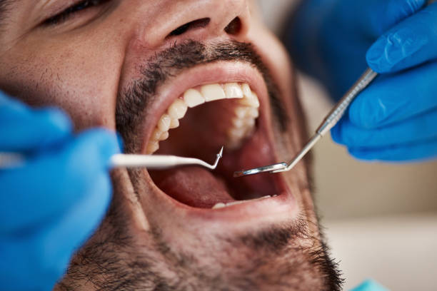 Best Full Mouth Reconstruction  in Moxee, WA